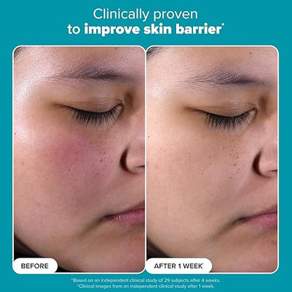 Paula's Choice SKIN PERFECTING 2% BHA Liquid Exfoliant with Salicylic Acid