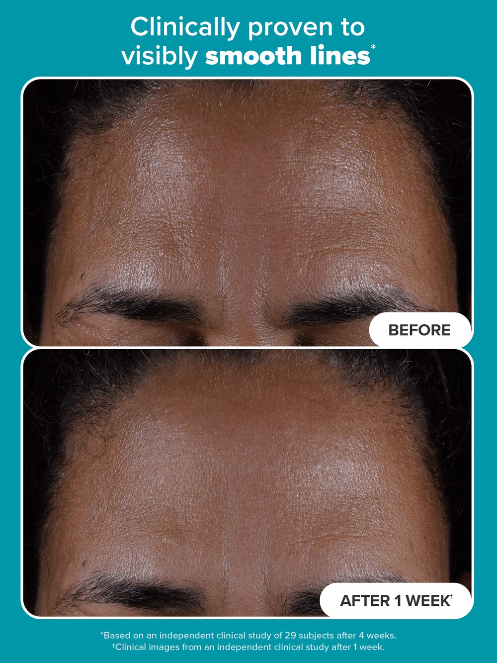 Paula's Choice SKIN PERFECTING 2% BHA Liquid Exfoliant with Salicylic Acid